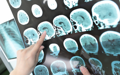 Sanitizing HTC VIVE Headsets That Are Helping Patients Recover From Strokes